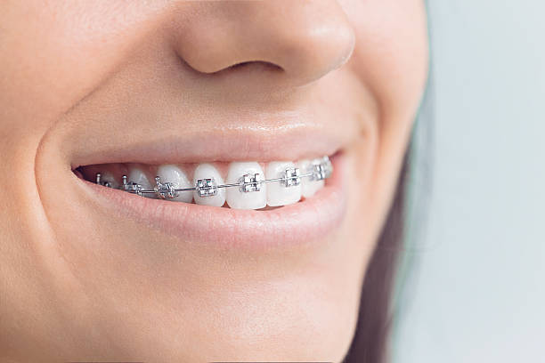 Best Veneers and Lumineers  in Arcadia, FL
